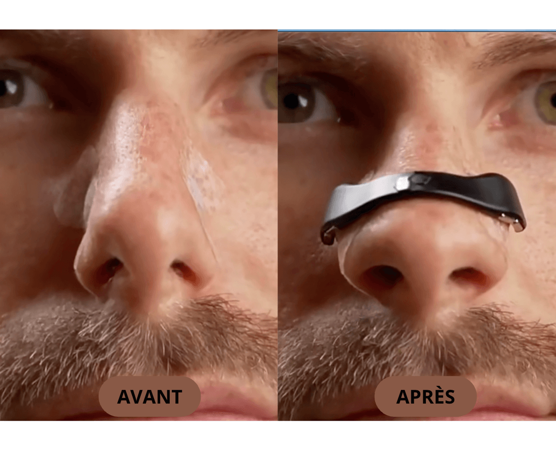 Bandes Nasales Magnétiques - Pureseal
