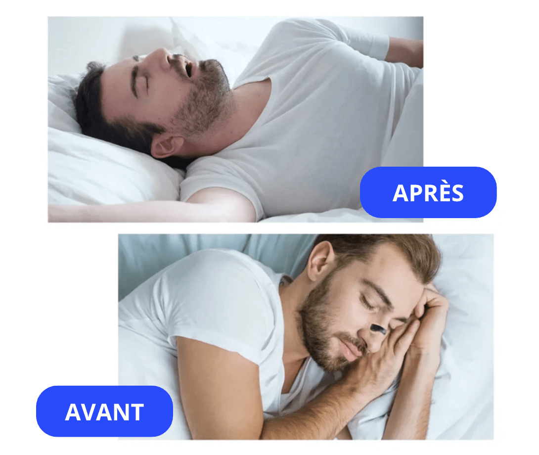 Bandes Nasales Magnétiques - Pureseal